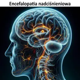 Encefalopatia nadciśnieniowa